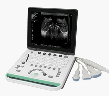 Prenosný Ultrazvuk Stroj na Humánne použitie a na Veterinárne Použitie