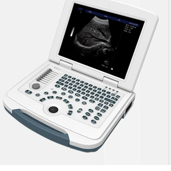 Vysoká kvalita ultrazvukové ZARIADENIA výrobcu sonography Echokardiografia prenosný ultrazvuk stroj cenu